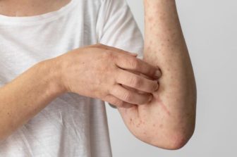 The Skin Itching Causes That Everyone Should Be Aware Of