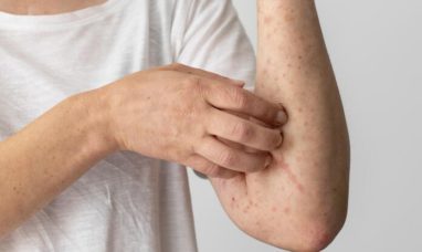 The Skin Itching Causes That Everyone Should Be Awar...