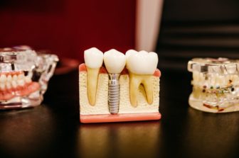 Common Careers in the Dental Industry