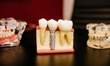 Common Careers in the Dental Industry